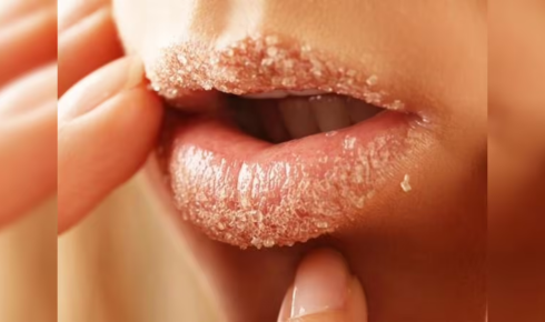 Lip Care Routine Dark Lips ko naturally kaise treat kare